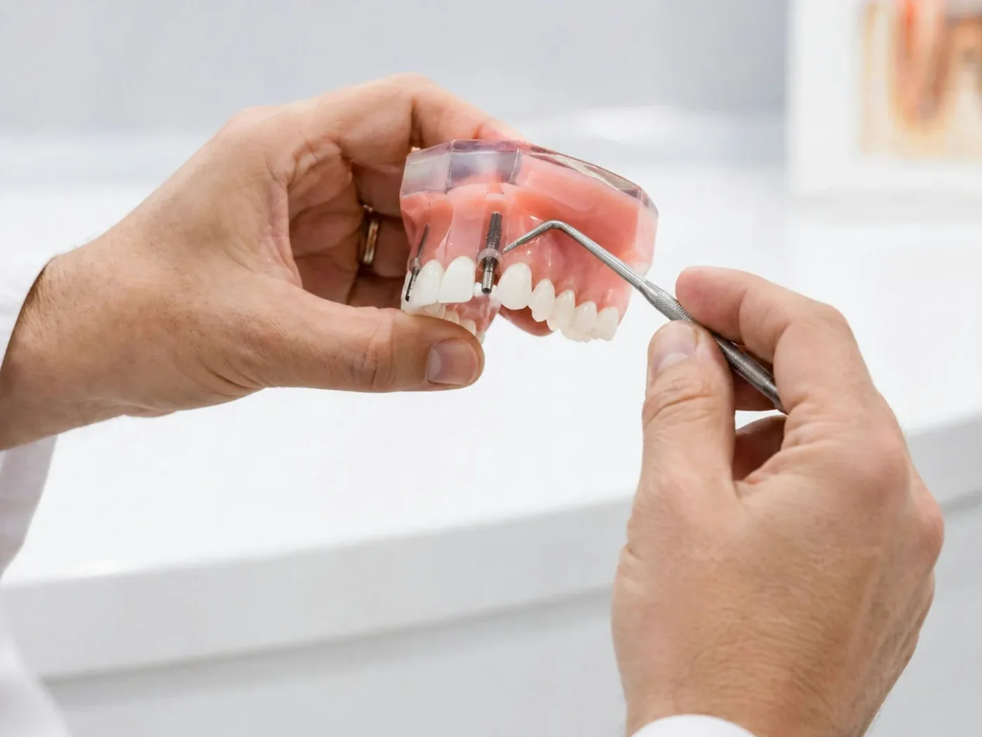 Hands holding a dental model during a consultation